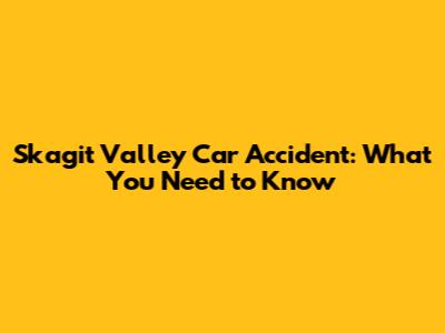 Skagit Valley Car Accident: What You Need to Know
